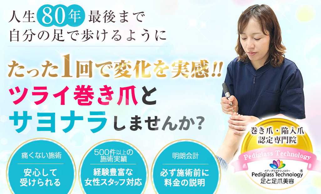 巻き爪TOP