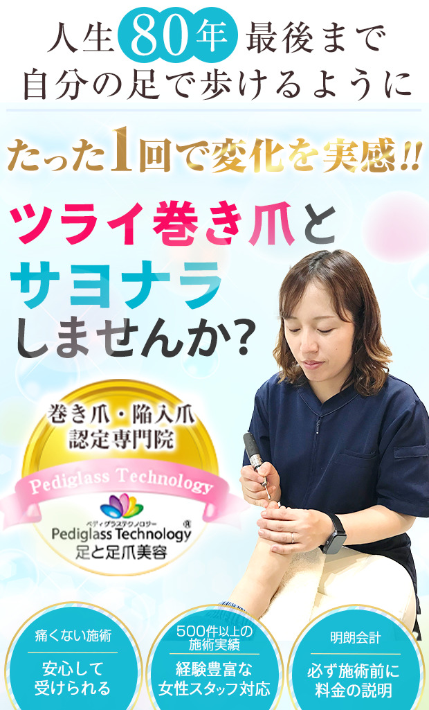 巻き爪TOP